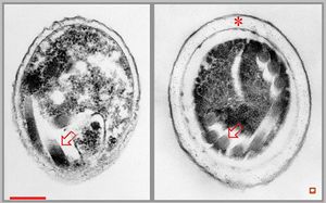 Nosema - brain, rabbit